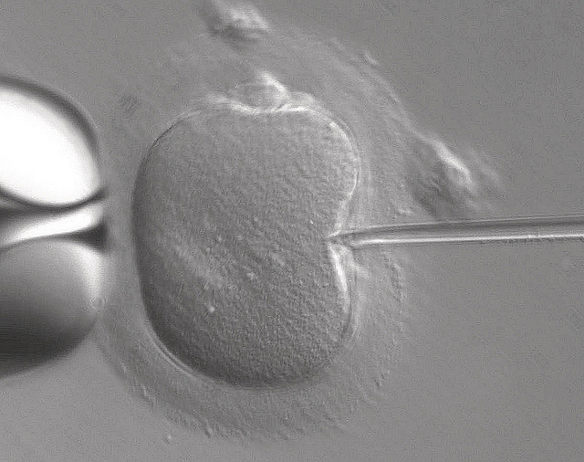 Foto: Flickr/ ZEISS Microscopy